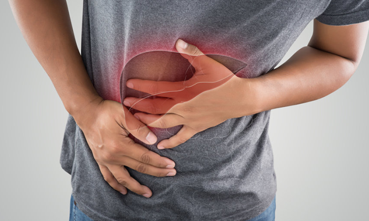What is Alcoholic Liver Disease? What is Alcoholic Liver Disease?